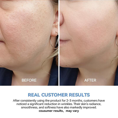 Ultra-Hydrating Serum -Vegan | 5% Hyaluronic Acid Glass Skin Single-Use Vials Skincare Comfort skin firming eyecream